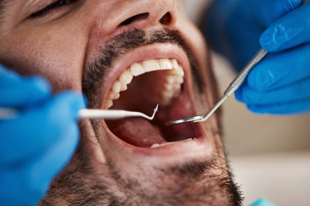 Best Weekend Emergency Dentist in North Bethesda, MD
